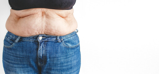 Close up of overweight woman belly with folds of skin in jeans, banner on white background with copy space for text, concept of health, aging and body care