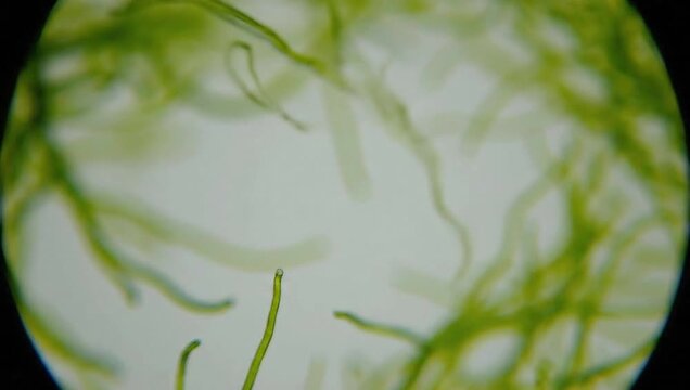 Microscopic view of green algae strands in water  