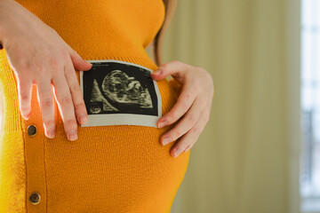 Prenatal ultrasound screening. Pregnant woman hands holding sonogram picture of unborn baby inside...