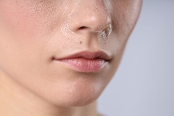 Fototapeta premium Woman with dry skin on her face against light background, closeup