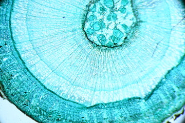 Zdjęcie mikroskopowe. Komórki roślinne. Łodyga drzewiastej rośliny dwuliściennej - przekrój poprzeczny. Powiększenie 40x.