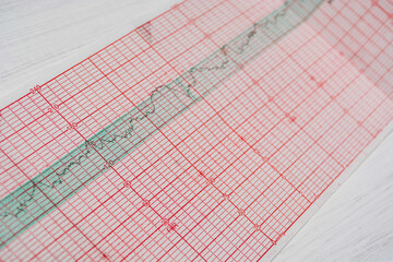 sheet with a heart cardiogram