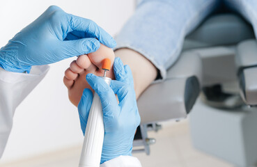 Obraz premium Podiatrist treating caucasian adult's foot for medical care