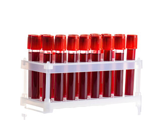 Test tubes filled with red liquid, arranged in a plastic rack