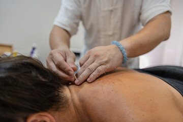Fototapeta premium Practitioner treating patient with acupuncture needles on back