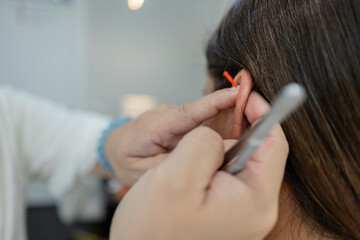 Specialist performing ear acupuncture treatment on a young woman