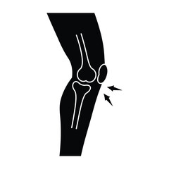 Simple black and white illustration of a human knee joint with pain
