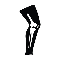 Simple black and white illustration of a human knee skeletal structure