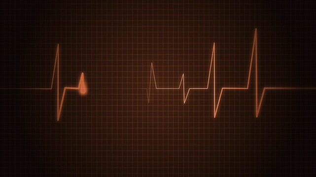 Heartbeat Line Wave Signal Animation with Continuous Pulse and Medical Monitoring