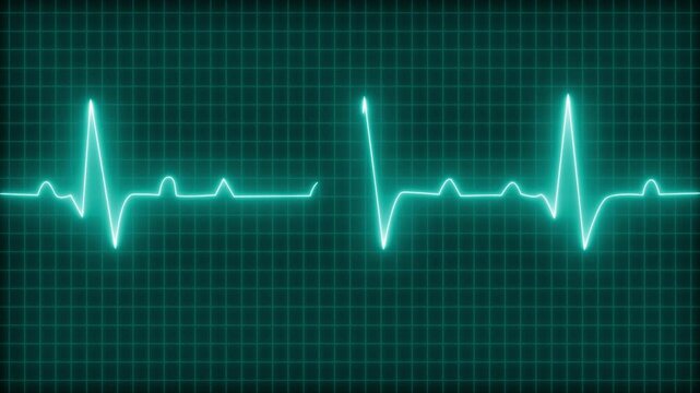 Electrocardiogram heartbeat waveform Line Animation - Powered by Adobe