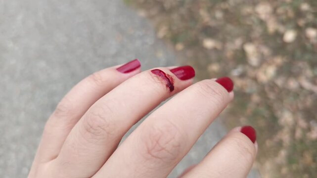 Blood flows from the wound down the woman's finger. The woman cut herself with sharp glass. Wound, finger injury