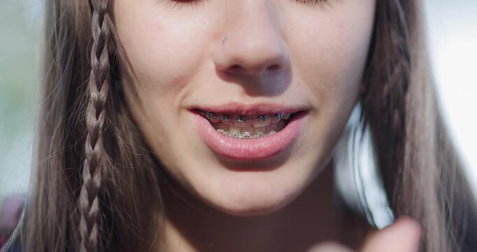 Smiling girl shows off braces while demonstrating how to adjust them in a sunny outdoor setting