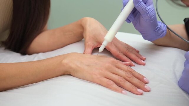 A cold plasma or non-equilibrium plasm for skincare. Removing dark spots, wrinkles, dry skin, pigmentation on hands. 