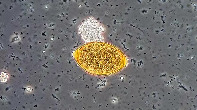 Stool sample under phase microscopy view, Trichuris egg 
