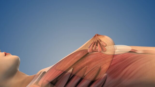 3D Medical Animation of Breast Prosthesis Implantation