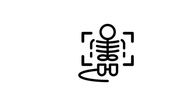Skeletal outline for diagnostic purposes, featuring square brackets and solid feet. Ideal for medical presentations and educational materials.

