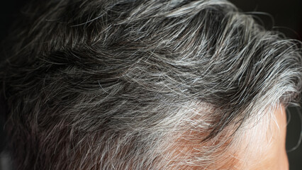 White hair and gray hair of man, hair health problems with hair loss and thinning.

