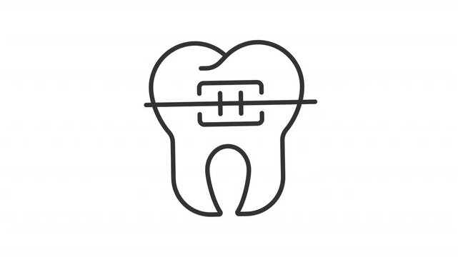 Animated orthodontic braces line icon. Stomatology care animation. Dental appliances to straighten teeth. Correct misaligned bites. Outline element on white background. HD video with alpha channel