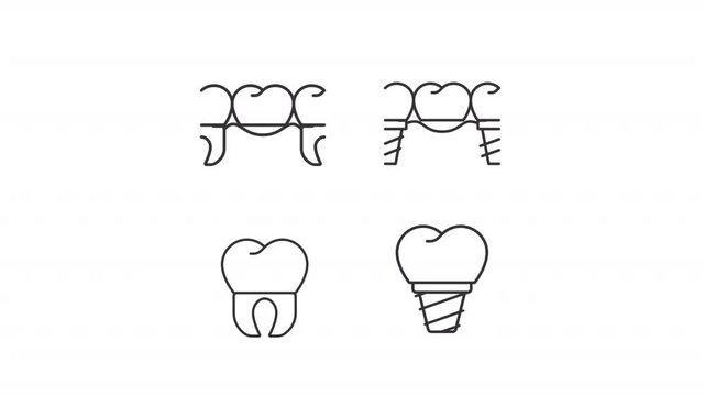 Animated missing teeth replacement line icons. Implants, dental crowns and bridges animation set. Orthodontic medical solutions. Outline elements on white background. HD video with alpha channel