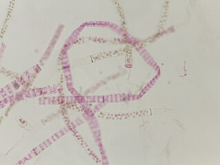 Sphaeroplea and Other Algae Filaments