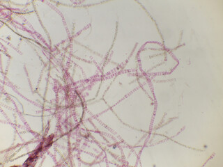 Sphaeroplea and Other Algae Filaments