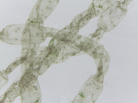Microscopic View of Oedogonium Filaments