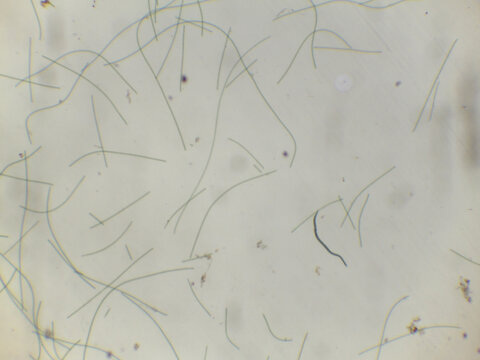 Oscillatoria: Filamentous Cyanobacteria Under Microscop