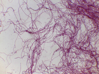 Tolypothrix: A Filamentous Cyanobacterium