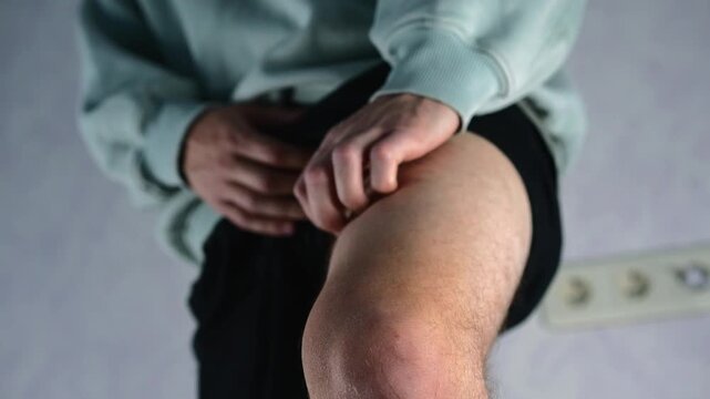 A guy standing in a room has itchy skin on his leg.
Close-up of a guy scratching his leg.
Itching and discomfort.
Scabies on the body.