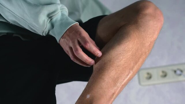 A man stands in a dark room and scratches his calf muscle.
Itchy leg.
Allergy to the skin of the leg or an insect bite.