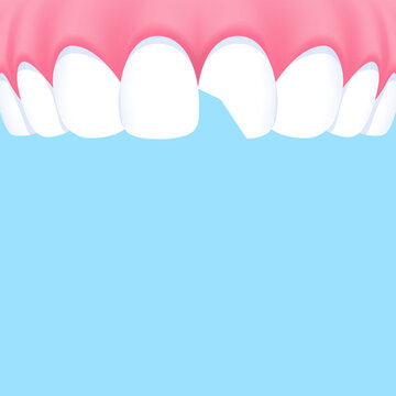 Upper teeth (Chipped) - Text box banner (square) illustration vector design. Dental care concept.