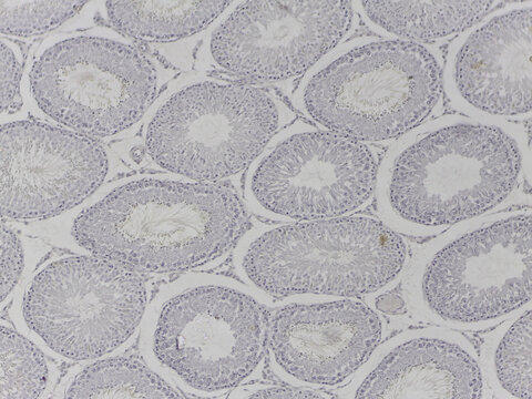 Spermatogenesis in Human Testis under the Microscop