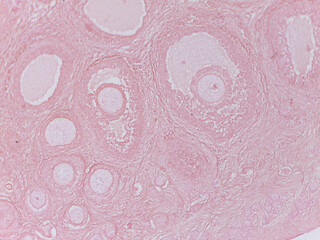 Human Ovary with Follicles under the Microscop
