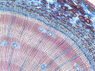  Pinus Stem Cross-Section with Annual Rings © Mohammed