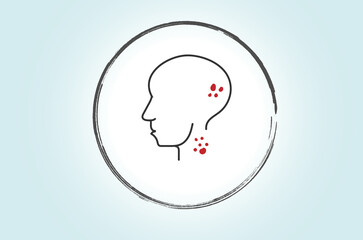 Head and neck cancer refers to malignant tumors that develop in the mouth, throat, larynx, nose, or other nearby structures, often requiring surgery, radiation, or chemotherapy for treatment