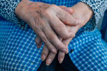 hands of a 90s woman with osteoarthritis