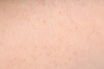 Texture of normal skin as background, closeup