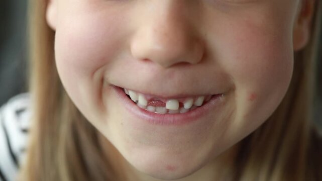 A child demonstrates the loss of a baby tooth. Concept of teeth care and. dentist service