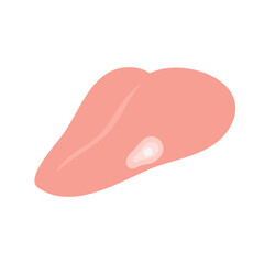 フチが白くなっている舌