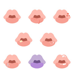 様々な症状の唇セット