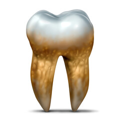 Dental Plaque and yellowish buildup on teeth caused by hardened tartar as a sticky film of bacteria as a symbol of oral health dentist and dentistry or Tooth bacterial disease.