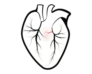 Illustration of a human heart with arteries and veins and a small red area indicating a problem area | editable eps vectors silhouette