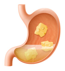 Human Stomach with cheese. The stomach digests cheese. A stomach filled with healthy and wholesome food. Proper nutrition. Realistic 3d Vector illustration. Food digestion process illustration