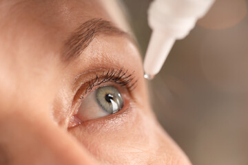 Woman applying eye drops on blurred background, closeup