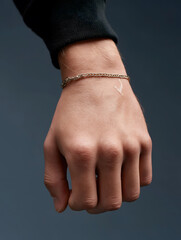 Eczema close up skin: Close up image shows wrist eczema cracked skin of an adult appearing itchy and uncomfortable because of dry skin