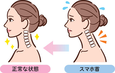スマホ首から正常な状態への変化イラスト（女性横顔）