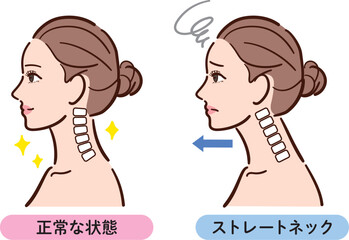 正常な状態とストレートネックの比較イラスト（女性横顔）