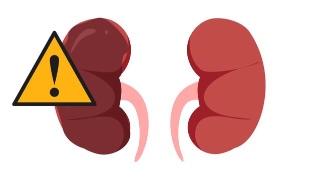 Kidney failure illustration animation. World kidney day	