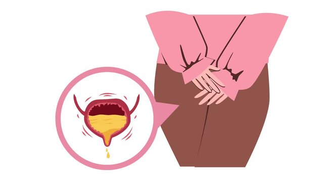 Urinary incontinence illustration animation	
