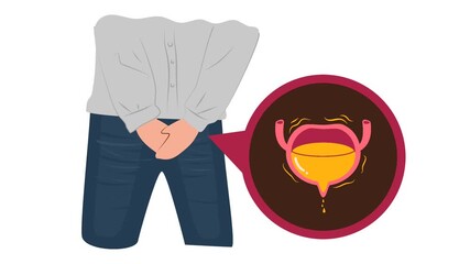 Urinary incontinence illustration animation. Overactive bladder 